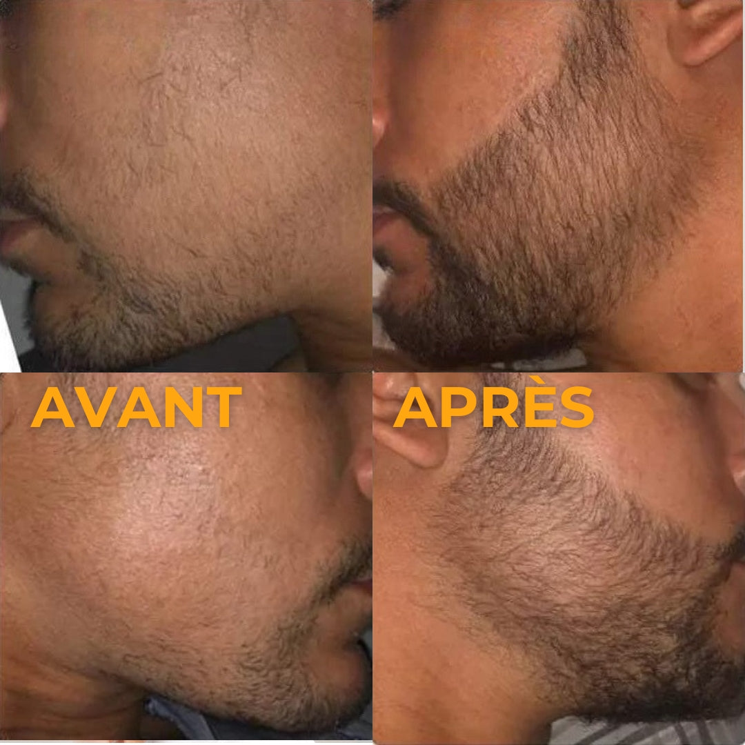 Batana Pure® : Activateur de Croissance
