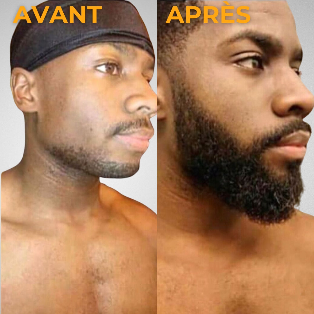 Batana Pure® : Activateur de Croissance
