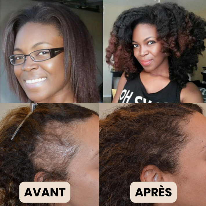 SilkHair France Huile de Batana 100 Naturelle N°1 en Europe SilkHair EUR