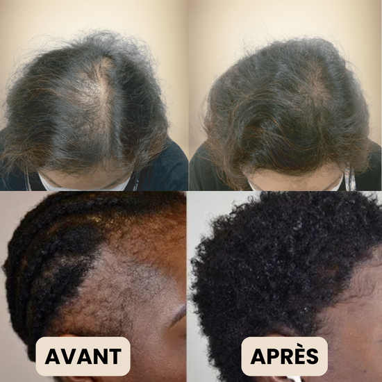 SilkHair France Huile de Batana 100 Naturelle N°1 en Europe SilkHair EUR